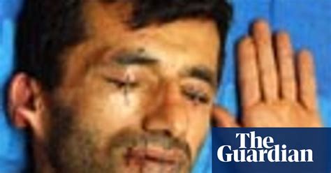 Refugee Sews Up His Lips Eyes And Ears Uk News The Guardian