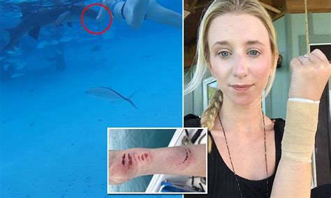 Footage Shows Newlywed Bride Bitten By Shark In Caribbean Daily Mail