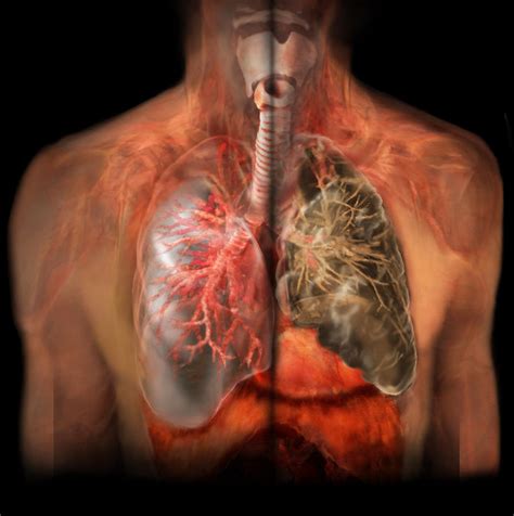 healthy lung  smokers lung photograph  anatomical travelogue