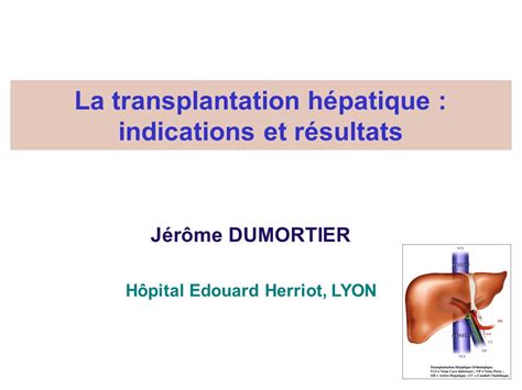 La Transplantation Hépatique Indications Et Résultats Pdf Etude Az