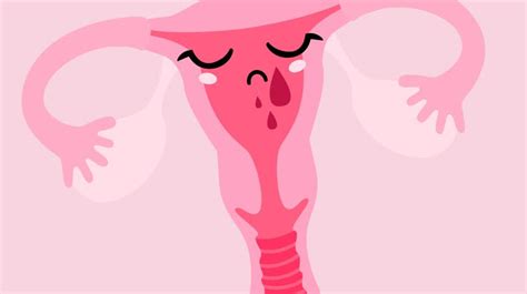 How Endometriosis Can Affect Your Sex Life