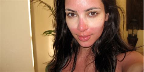 celebrate summer with 24 awkward celebrity sunburns