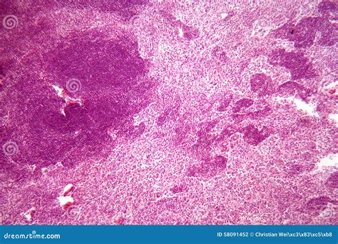 lymph node cells   microscope stock photo image