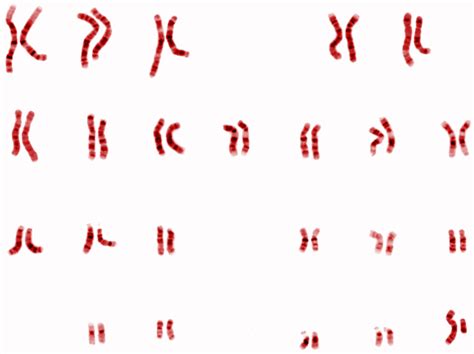 There Are Pairs Of Chromosomes In Human Beings Class 12 Biology Cbse