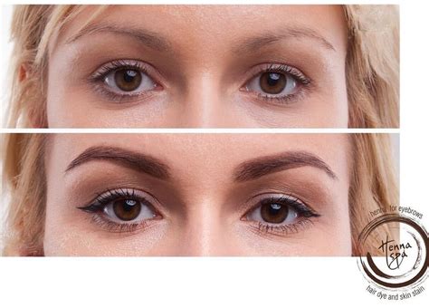 eye enhancements