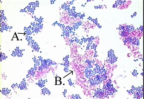 acid fast stain principle procedure interpretation