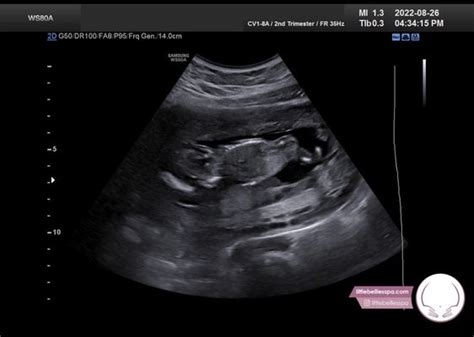bellies ultrasound pregnancy spa tampa