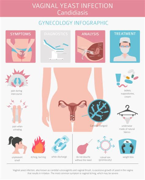 40 Gynecological Biopsy Illustrations Royalty Free Vector Graphics