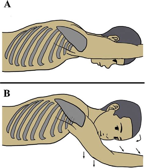 positions  surgery  conventional arm position   prone  scientific