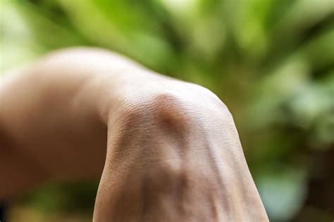 doctors   knew  ganglion cysts  healthy