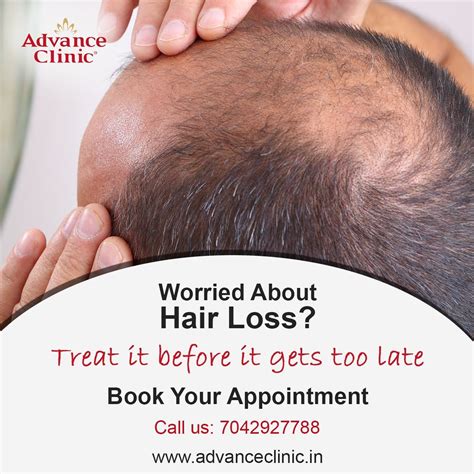 worried about hair loss but not satisfactory solutions get instant