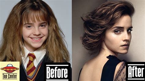 Emma Watson Then And Now Youtube