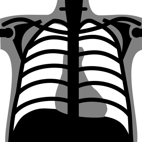 chest  ray clipart   cliparts  images  clipground