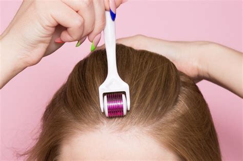 why experts say to avoid diy microneedling for hair loss