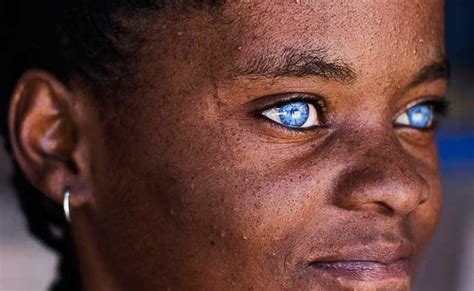 20 Amazing Pictures Of Black People With Blue Eyes