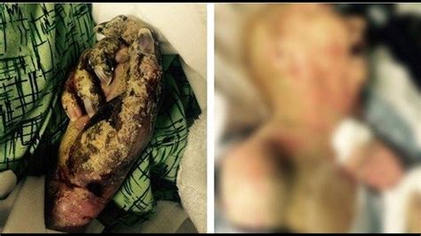 Eaten Alive Woman Known For Beauty Suffers Horrific Death At Nursing
