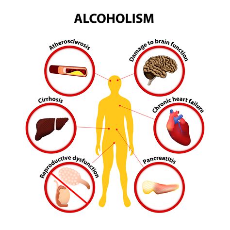 alcoholism negatively impact  health racnj
