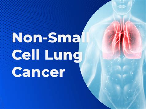 non small cell lung cancer types of lung cancer massive bio