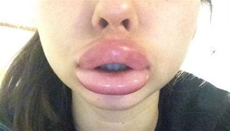 kylie jenner challenge see why teens are paying the price to give