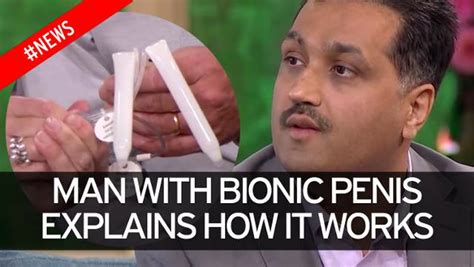 How My Bionic Penis Works Man Fitted With Inflatable Implant Explains