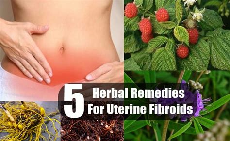 Natural Remedies For Uterine Fibroids 247 Best Sellers Reviews