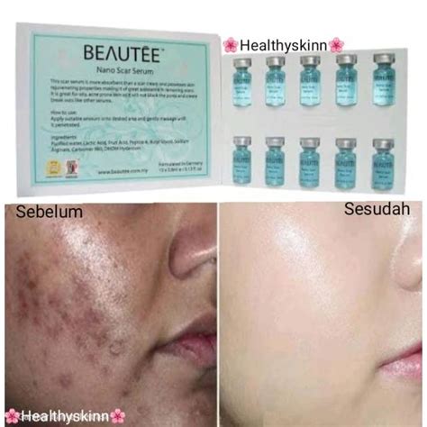 Jual Serum Penghilang Bopeng Ampuh Original Dermaroller Dermapen Bekas