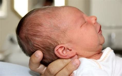 newborn care head  neck philadelphia fight