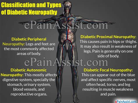 Diabetic Neuropathy Classification Types Causes Risk