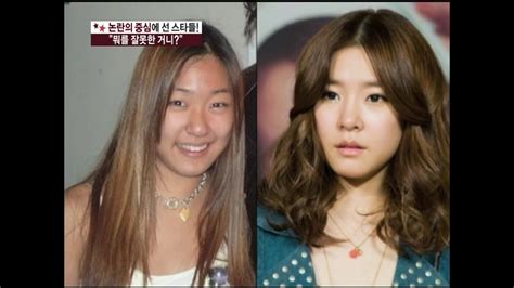 【tvpp】snsd Controversy Of Cosmetic Surgery 소녀시대 소녀시대
