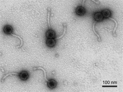 acne   avoid acne causing bacteria  ideas