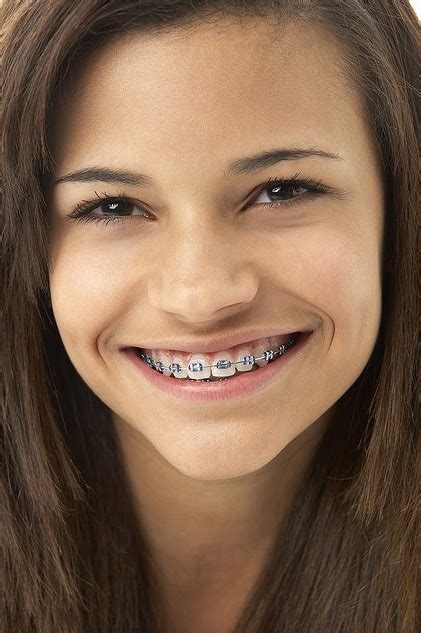 the hunt orthodontics blog dr hunt and our team think that braces are pretty cool do you