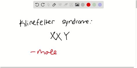 In Humans Klinefelter Syndrome Is Caused By What Sex… Solvedlib