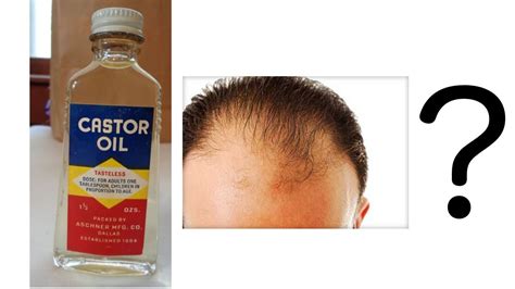 Castor Oil For Hair Loss Does It Work Youtube