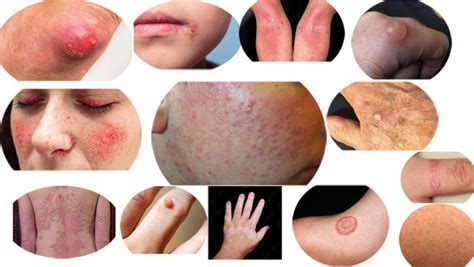 learn  common skin disorders health beauty tips