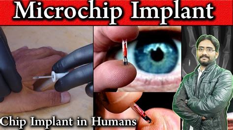 microchip implant  humans  future  identity rfid chip implants future tech