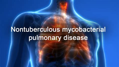 Nontuberculous Mycobacterial Pulmonary Disease Pulmonary Health Hub