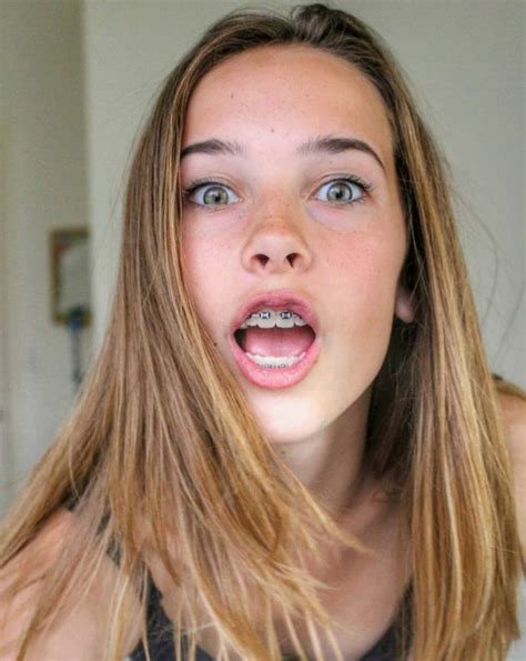 pin by jamie richie on about face braces girls cute braces