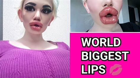 The Biggest Lips On Earth