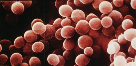 mechanisms  bacterial pathogenicity
