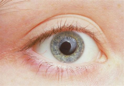 human eye showing dilated pupil photograph  martin dohrnscience