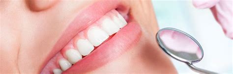 clean dental implants full mouth dental implants