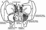 Sinuses Paranasal Sinus Ethmoid Maxillary Cancer Gif sketch template
