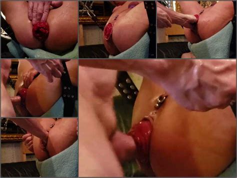 prolapse porn amateur amazing gays porn fisted and fuck huge anal prolapse rare fisting videos