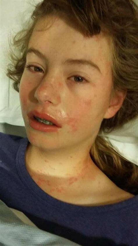 mum releases horrifying photos of teen daughter in desperate bid to