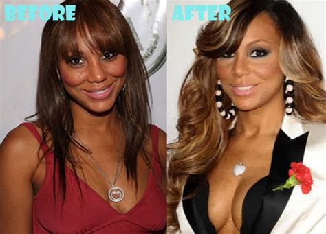 Tamar Braxton Plastic Surgery Fact Or Rumor Lovely Surgery