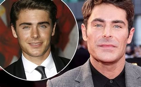 what happened to zac efron s jaw surgery facial remodeling and plastic