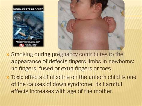 The Effect Of Smoking On Pregnancy And The Fetus Online Presentation