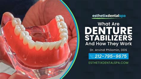 denture stabilizers    work esthetix dental spa