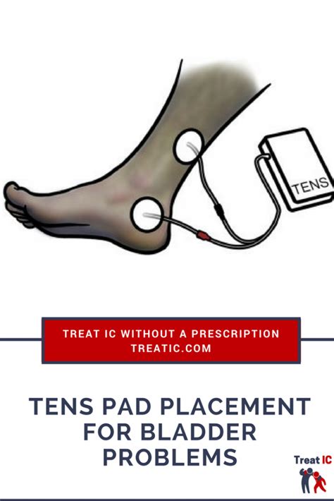 tens placement  ic   bladder urgency  frequency treat ic