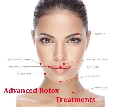 pin by tatiana selliach on magical needles botox and fillers